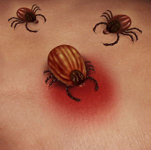 lyme disease